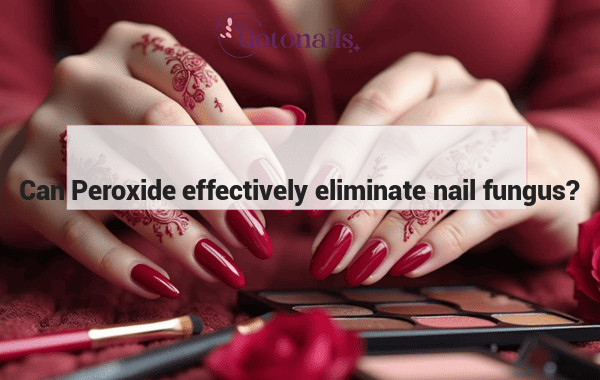 Can Peroxide effectively eliminate nail fungus?